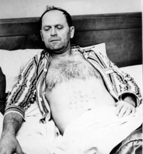 The Falcon Lake UFO Incident of 1967 and Its Mysterious Physical Evidence 43 Falcon Lake UFO Incident eye witness burned